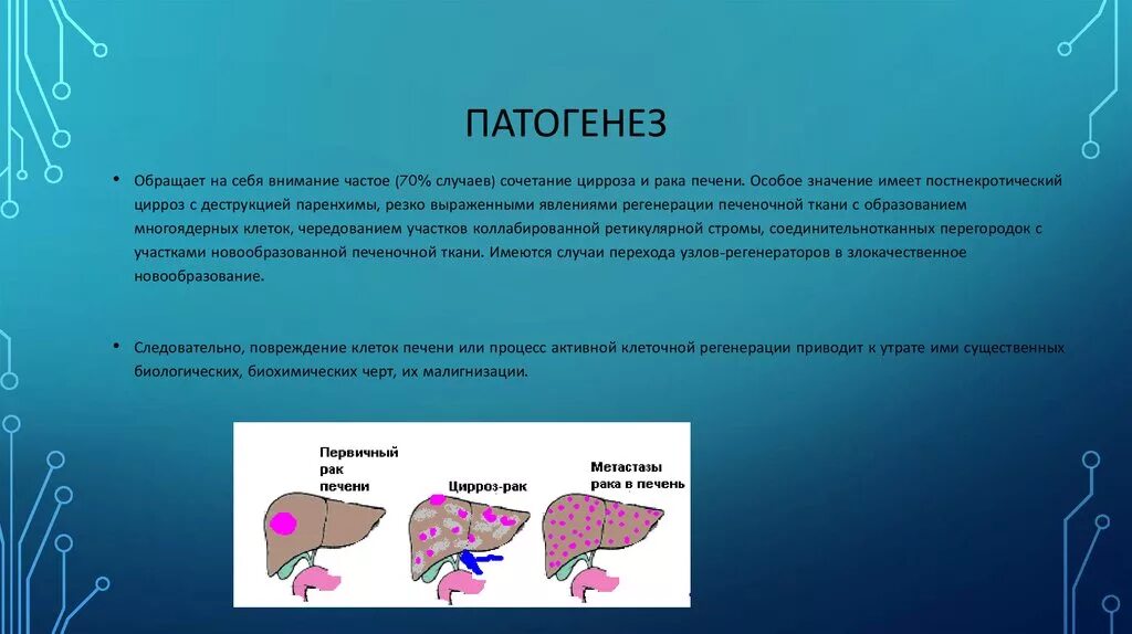 Рак печени 4 стадия фото Рак печени 4 стадия прогноз: найдено 85 изображений