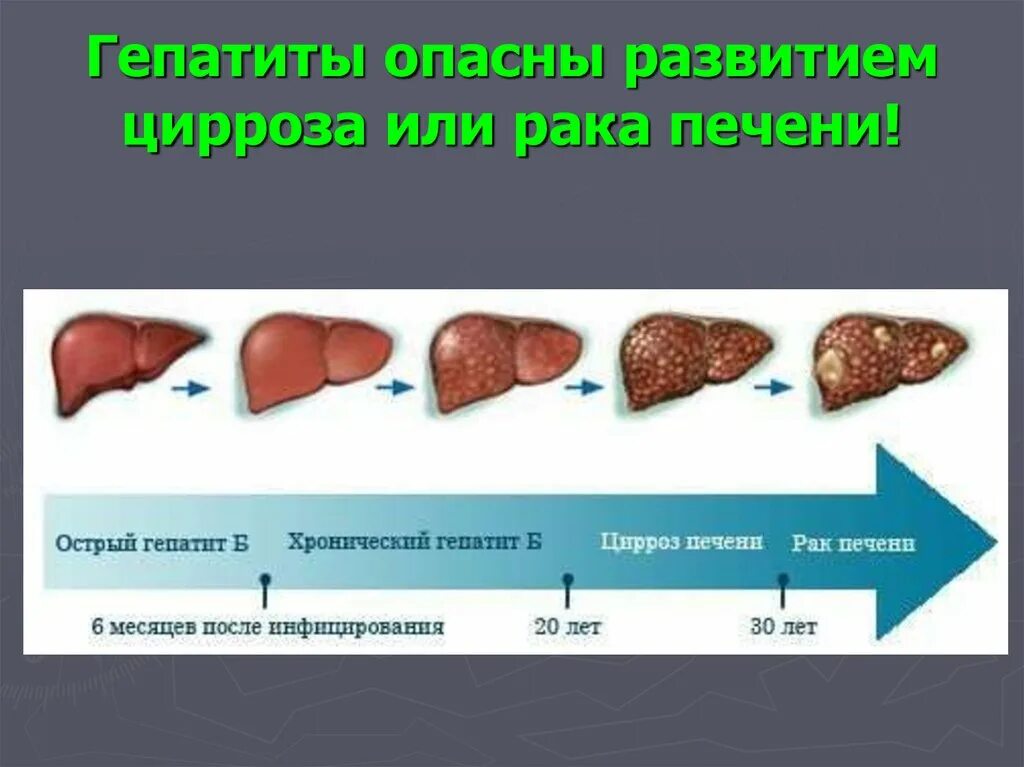 Рак печени фото Смертельный враг: рак печени и его разрушительное воздействие