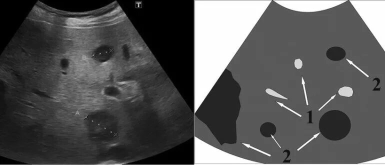 Рак печени на узи фото Доктор онлайн - Страница 118 из 415 - Советы доктора