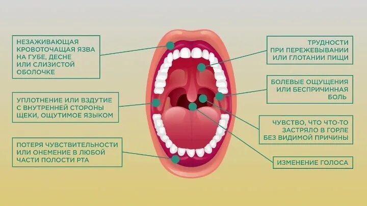 Рак полости рта симптомы первые признаки фото Неделя ответственного отношения к здоровью полости... Интересный контент в групп