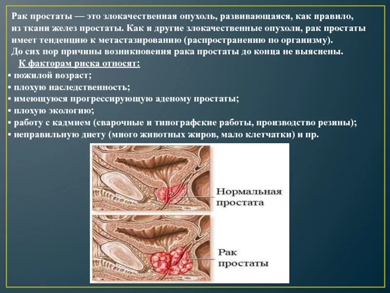 Рак предстательной железы симптомы фото Рак предстательной железы карта вызова