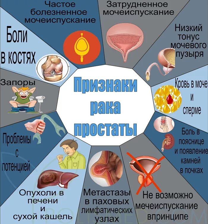 Рак предстательной железы симптомы фото Рак простаты. Причины, симптомы, стадии, лечение заболевания. Операция при раке 