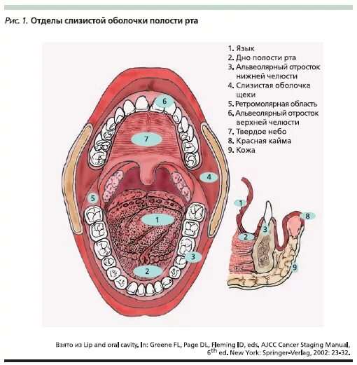 Рак ротовой полости фото начальная стадия Вопросы лечения рака полости рта " Библиотека врача