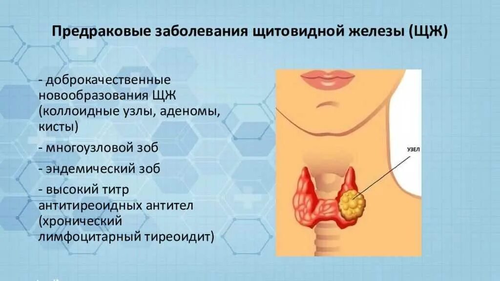 Рак щитовидной железы симптомы у женщин фото Картинки ЩИТОВИДНАЯ ЖЕЛЕЗА МЕТОДЫ ИССЛЕДОВАНИЯ