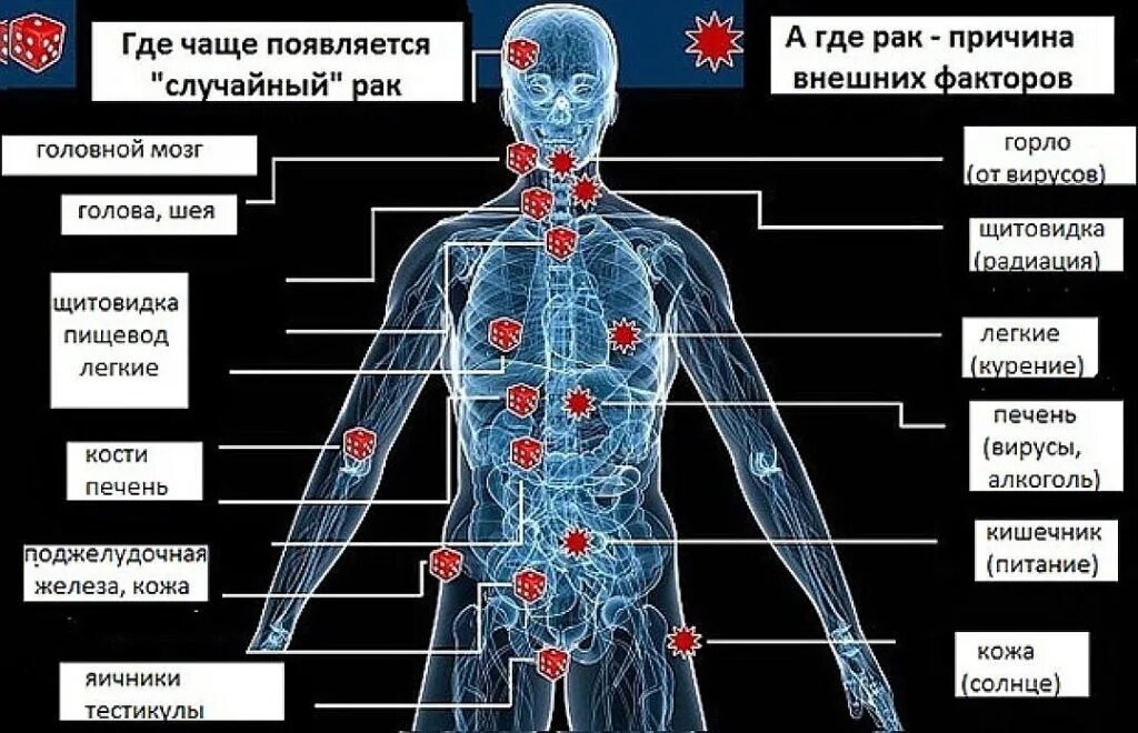 Рак симптомы фото первые признаки рака Здоровый образ жизни-основа профилактики онкологических заболеваний! - ГБУЗ "Уст