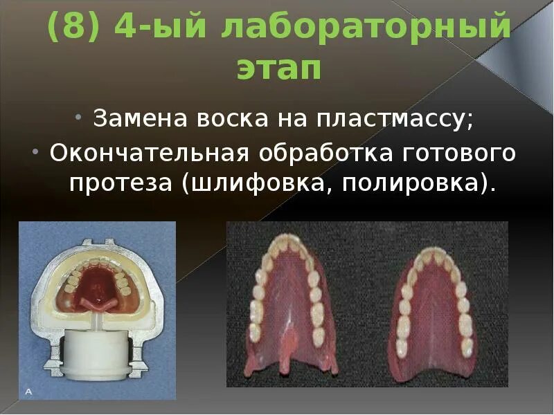 Рак твердого неба фото Полные съёмные пластиночные протезы (ПСПП)