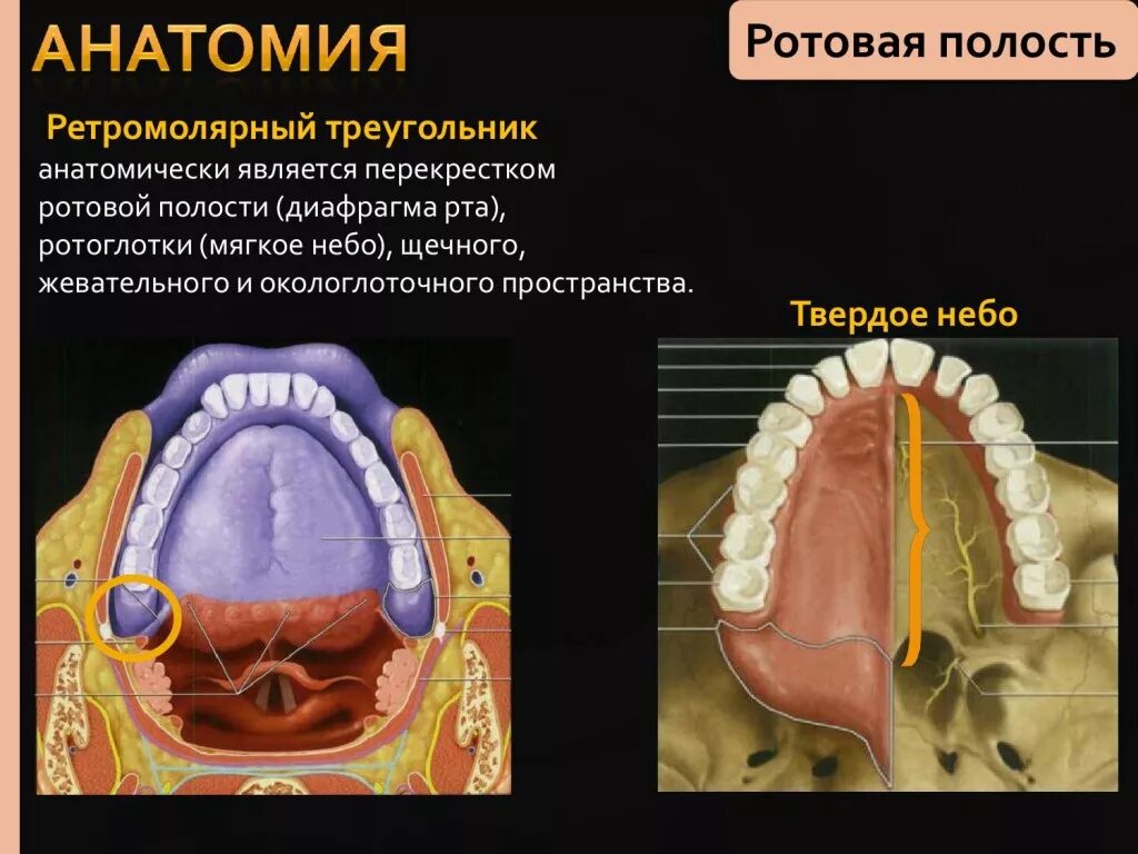 Рак твердого неба фото как выглядит КТ-диагностика злокачественных опухолей ротовой полости, глотки, гортани