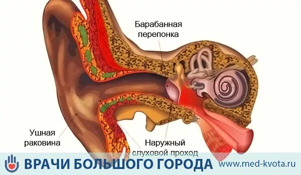 Рак уха фото Операция по удалению рака уха в Москве: цены и стоимость, прогноз