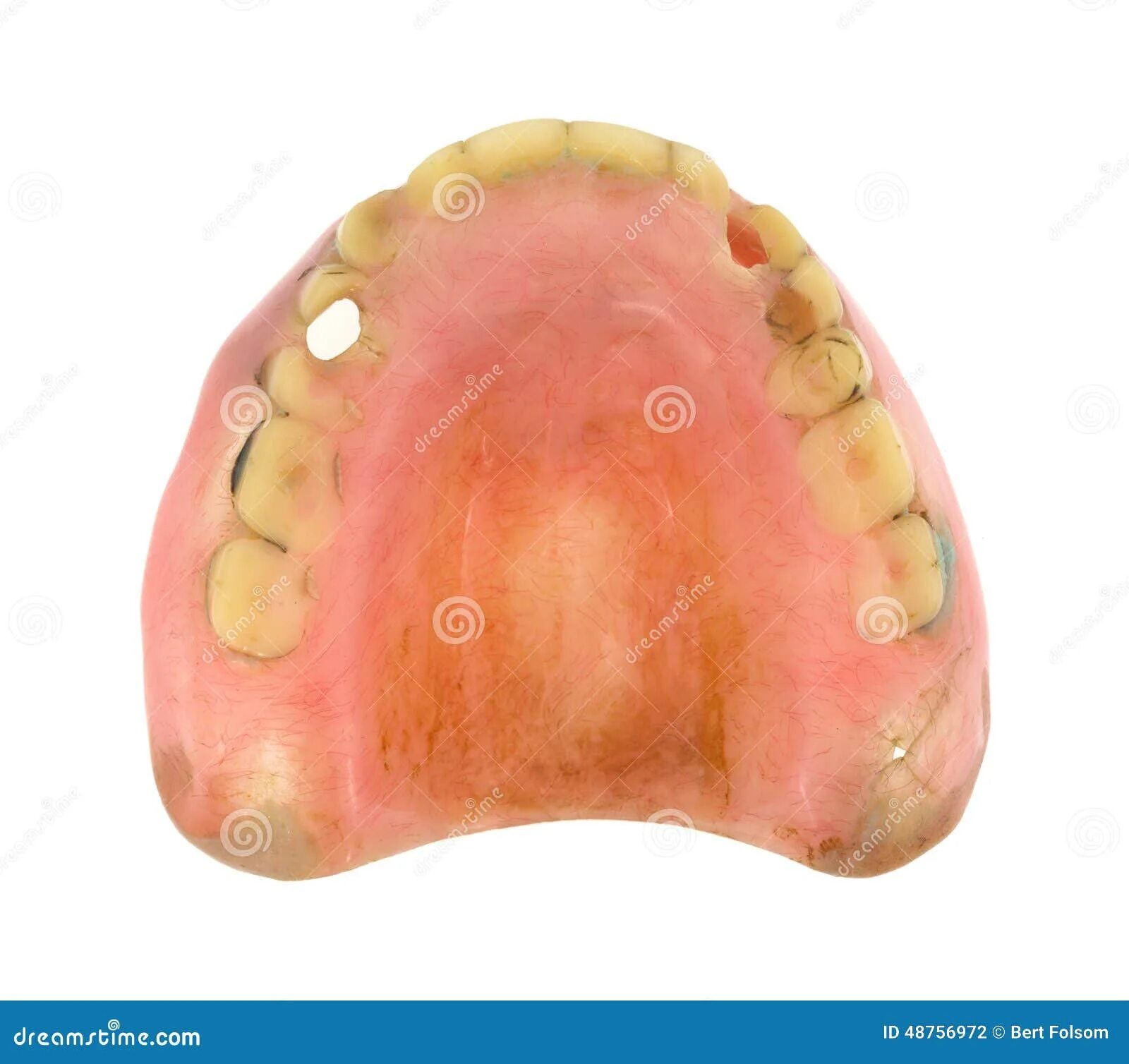 Рак верхнего неба фото Top View Worn Denture Teeth Stock Photo - Image of worn, dental: 48756972