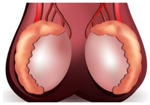 Рак яичек симптомы фото Причины возникновения опухоли яичка у мужчин: как лечить новообразование в завис