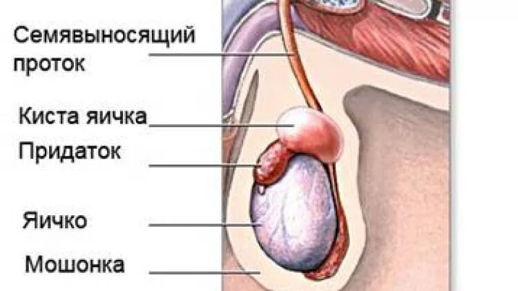 Рак яичек у мужчин симптомы фото Рак яичка: причины, первые признаки и симптомы