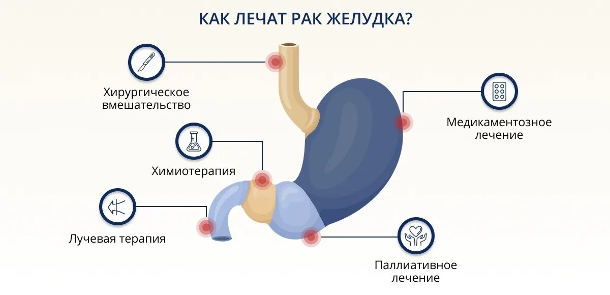 Рак желудка симптомы фото Рак желудка: методы и способы лечения онкологии желудка на разных стадиях