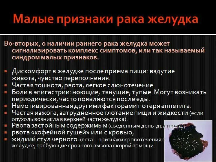 Рак желудка симптомы фото Симптомы и первые признаки рака желудка. проявления у мужчин и женщин