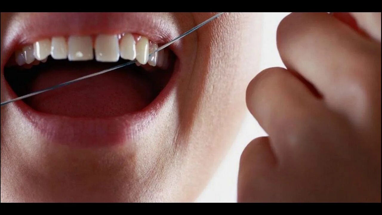 Рак зуба фото Hair Disorders Causes Teeth Decay - Why- How To Overcome - YouTube