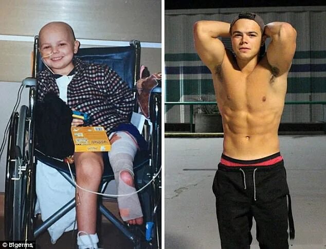 Раковые больные фото до и после Cancer survivors post transformation photos on Bored Panda