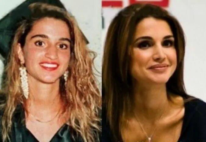 Рания до пластики фото Pin by Nadya on Middle Eastern Royalty & Weddings Queen rania, Plastic surgery, 