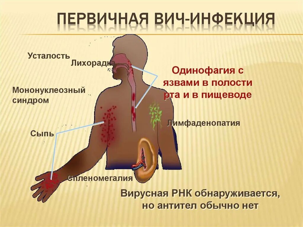 Ранняя стадия вич у женщин фото ОСНОВНАЯ ПРОБЛЕМА ИЗЛЕЧЕНИЯ ВИЧ-ИНФЕКЦИИ Медицина 2.0 Дзен