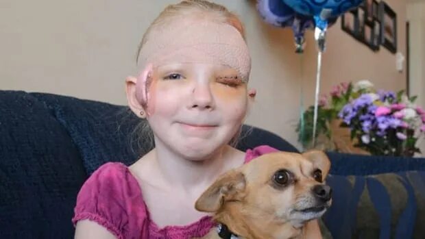 Раны после укуса собаки фото Chihuahua commended for defending B.C. girl from pit bull CBC News