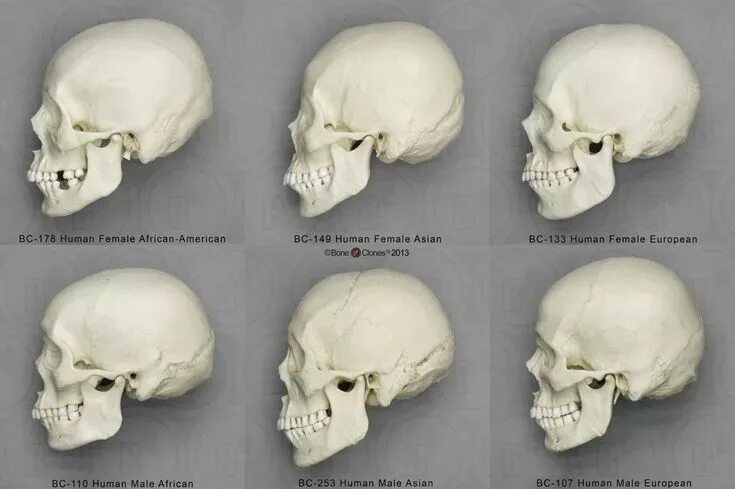 Раскололся череп у человека фото formas de craneos humanos - חיפוש ב-Google Skull reference, Skull anatomy, Anato