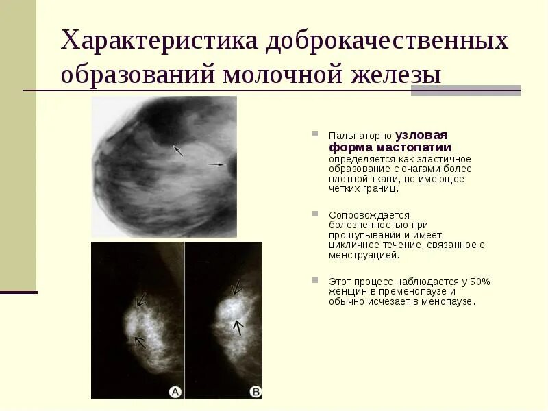 Распад опухоли молочной железы 4 стадия фото Отек молочной железы при раке - найдено 90 картинок