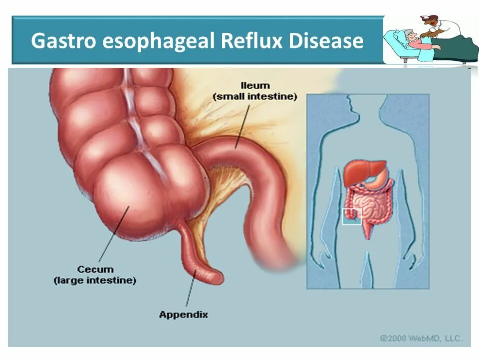 Расположение аппендицита у человека схема Care of Patient with respiratory Disorder ppt download