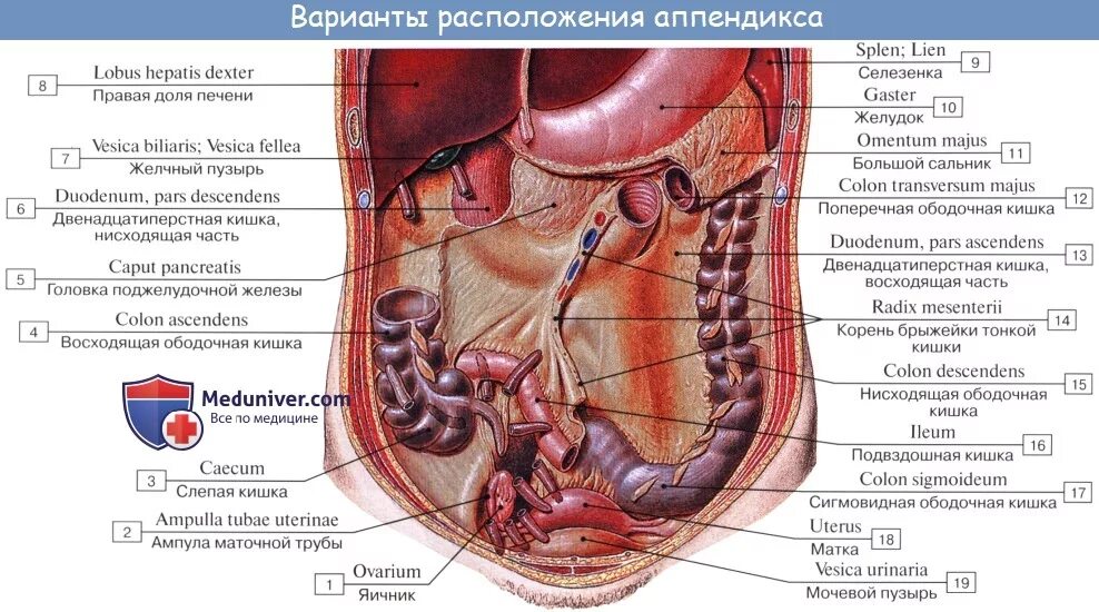 Расположение аппендицита у человека схема Анатомия человека: Слепая кишка. Червеобразный отросток ( апендикс, аппендикс ).