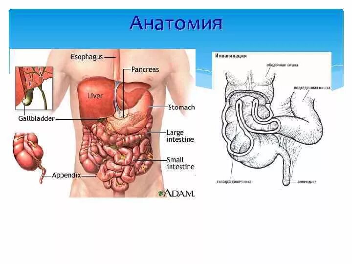 Расположение аппендицита у человека схема Организм человека аппендицит: найдено 88 изображений