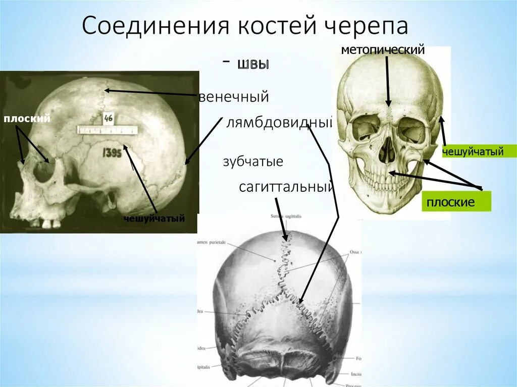 Расположение костей черепа схема Картинки КОСТНЫЕ ШВЫ ЧЕРЕПА