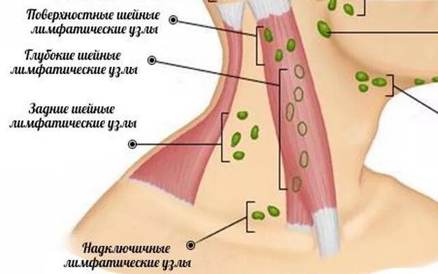 Расположение лимфоузлов на шее человека схема Лимфатическая система при онкологии 7 путей развития рака