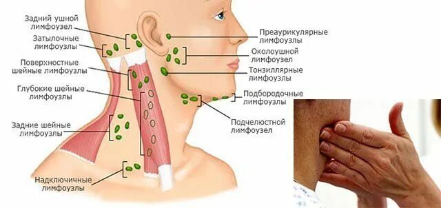Расположение лимфоузлов на шее человека схема https://www.liveinternet.ru/users/4651686/post468318688