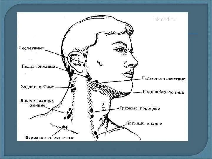 Расположение лимфоузлов на шее человека схема Твердые лимфатические узлы