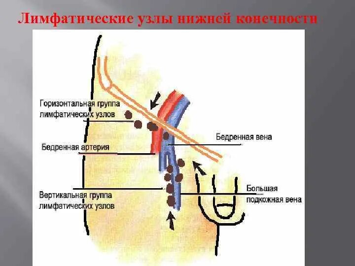 Расположение лимфоузлов в паху у мужчин схема Лимфоузел на ноге у мужчин: найдено 71 изображений