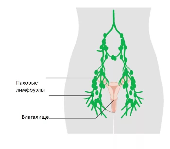 Расположение лимфоузлов в паху у мужчин схема Лимфоузлы в паху у женщин: расположение, причины воспаления и особенности лечени