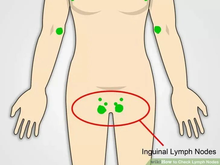 Расположение лимфоузлов в паху у женщин схема Pin on Anatomy