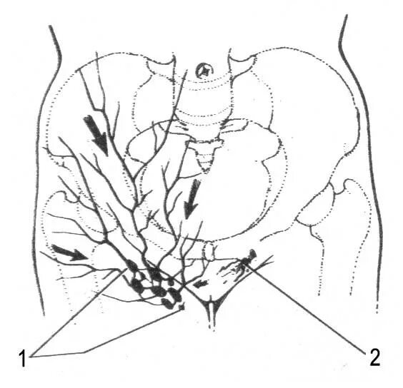 Расположение лимфоузлов в паху у женщин схема Глава 1. Анатомо-топографические особенности брюшной стенки и женских половых ор