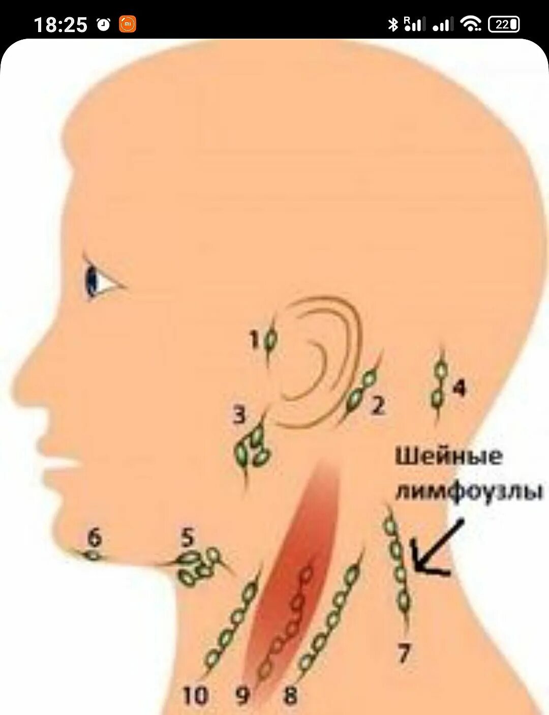 Расположение лимфоузлов возле уха фото Картинки ВОСПАЛЕНИЕ ЛИМФАТИЧЕСКИЕ УЗЛЫ У ДЕТЕЙ