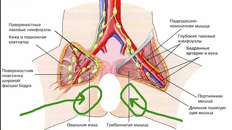 Расположение паховых лимфоузлов у женщин схема Где Паховые Лимфоузлы У Женщин Фото - Mixyfotos.ru