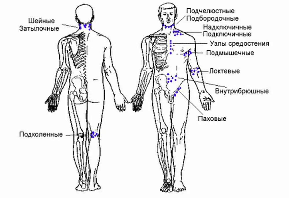 Расположение паховых лимфоузлов у женщин схема Картинки ПРОХОДЯ ЧЕРЕЗ ЛИМФАТИЧЕСКИЕ УЗЛЫ