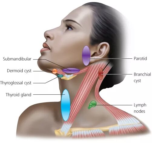 Расположение подчелюстных лимфоузлов у человека схема Neck Swellings Ento Key