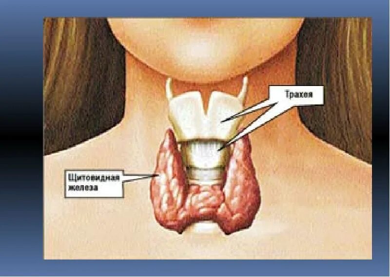 Расположение щитовидки на горле фото Как улучшить функционирование щитовидной железы без хирургического вмешательства