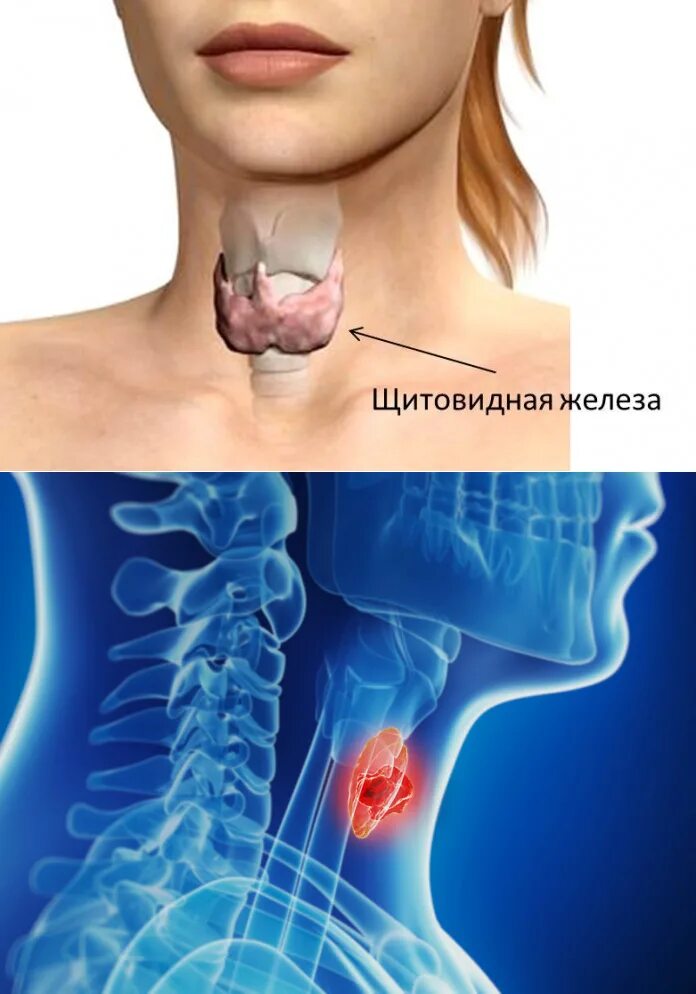Расположение щитовидки на горле фото Обнаружили щитовидку