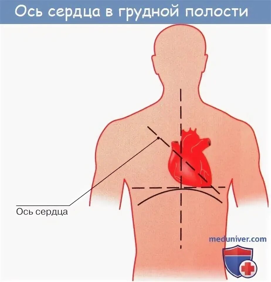 Расположение сердца у мужчины фото Анатомия: Положение сердца. Типы положения сердца. Величина сердца