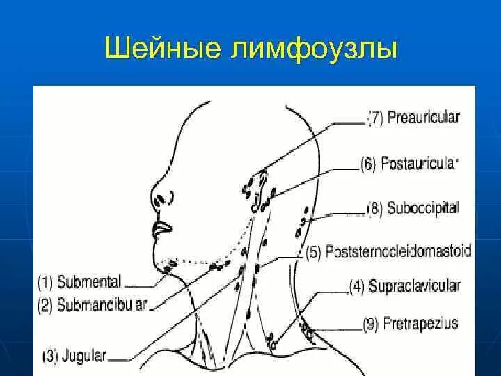 Расположение шейных лимфоузлов у человека схема Лимфоузлы на шее расположение схема