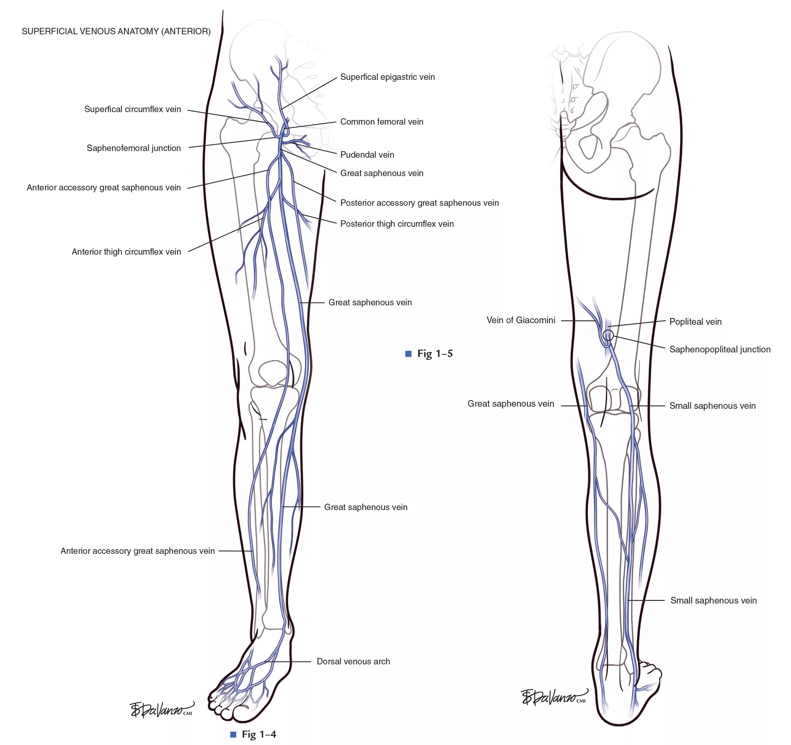 Расположение вен на ногах человека схема Greater Saphenous Vein Clot on Sale www.beztabaka.by