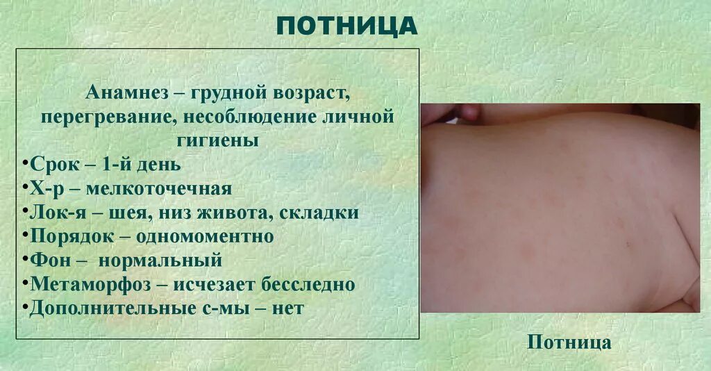 Распознать сыпь по фото Потница. Причины, симптомы и лечение