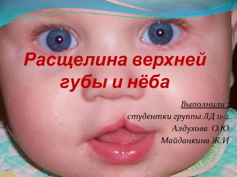 Cleft Lip Hellenic Craniofacial Center