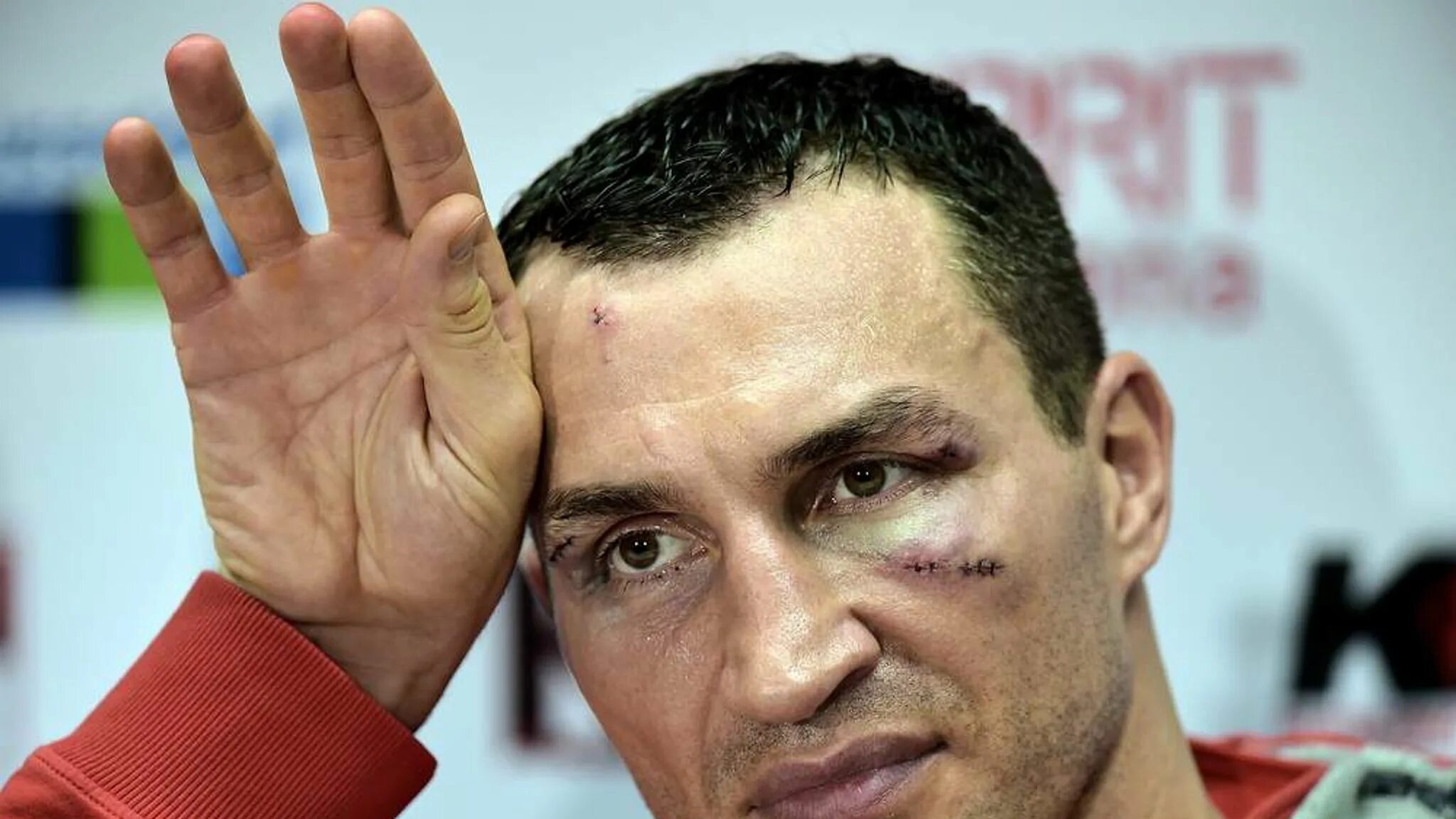 Рассечение брови фото Klitschko Determined To Turn Tables On Fury Scoop News Sky News