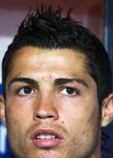 Рассечение брови фото Cristiano Ronaldo : LiveInternet - Российский Сервис Онлайн-Дневников