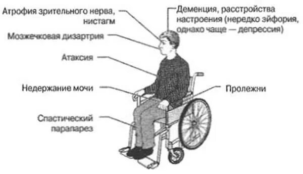 Рассеянный склероз симптомы у женщин фото Картинки КАК ЖИВЕТЕ С РАССЕЯННЫМ СКЛЕРОЗОМ ФОРУМ