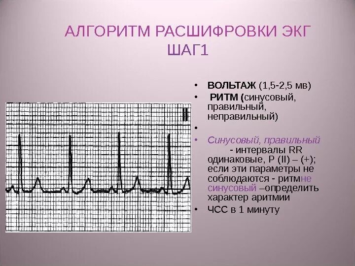 Расшифровать кардиограмму сердца онлайн по фото Mac OS-все-в-одном, красиво, удобно, надежно, но почему все сидят под Win? (част